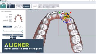 Clear aligner software thermoforming or direct printing [upl. by Yeneffit141]