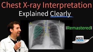 How To Scan Appendix  Ultrasound Probe Positioning  Transducer Placement  Abdominal USG Scanning [upl. by Kcinom548]