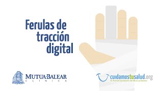 El INNOVADOR TRATAMIENTO DE FÉRULAS DE TRACCIÓN DIGITAL [upl. by Enneirdna843]