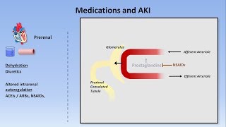 Acute Kidney Injury Part 13  Definitions and Etiologies [upl. by Nnylaj]