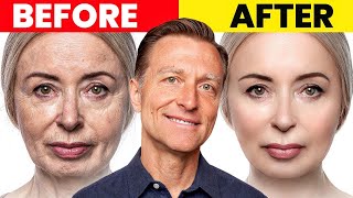 The Ultimate Face Transformation–Dr Bergs Best Remedy for Dry Skin and Wrinkles [upl. by Yenduhc]