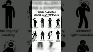 FOOD ALLERGY SIGNS AND SYMPTOMS medicos common people [upl. by Idonah]