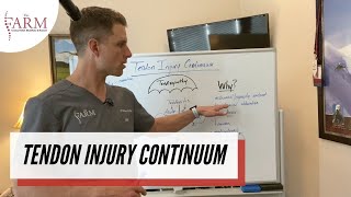 Tendinitis or Tendinosis The Tendon Injury Continuum [upl. by Itnuahsa156]