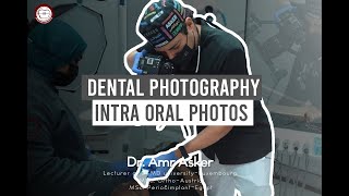 dental photography in relation to orthodontics part II intra oral photographs [upl. by Ymmak]