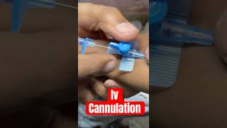 Iv cannulation cannula ivtherapy mbbs aiims SMpharmacy subscribe medicalequipment [upl. by Everrs]