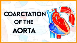 Coarctation of the aortaCoAtypes etiologypathophysiologyclinical featurediagnosis amp treatment [upl. by Gildus]