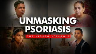 Life with Psoriasis  A New Struggle Every Day  A Strong and Inspiring Story drmeghachaturvedi [upl. by Adnuhsal]