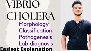 Vibrio Cholera  Vibrio Cholera Microbiology [upl. by Rois159]