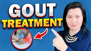 Effective Treatments for Gout The Ultimate Guide [upl. by Mcripley]