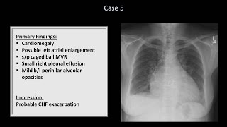 How to Interpret a Chest XRay Lesson 10  Self Assessment Part 1 [upl. by Gallager568]