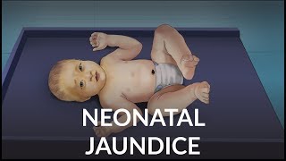 Neonatal Jaundice by L Veit  OPENPediatrics [upl. by Ohcamac]