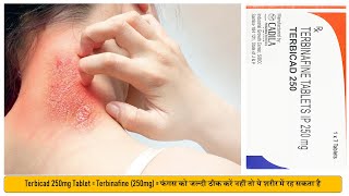 Terbicad 250mg Tablet  Terbinafine 250mg  Treat Fungal Infection फंगल इन्फेक्शन में उपयोगी [upl. by Esirehs]