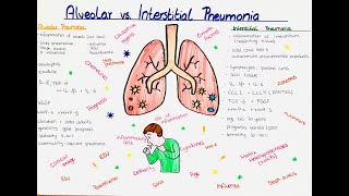 Alveolar vs Interstitial Pneumonia comparison [upl. by Oibaf]