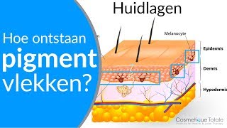 PIGMENTVLEKKEN  Hoe ontstaan pigmentvlekken  Wat zijn pigmentvlekken [upl. by Aver585]