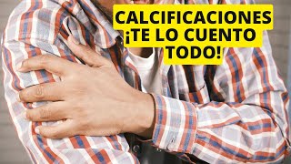 Calcificaciones 🦴 tendinosas te lo cuento TODO [upl. by Anehta]