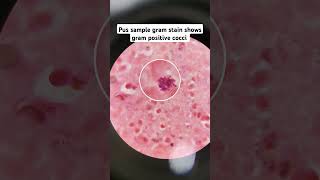 gram positive cocci drmicro microscope infection [upl. by Trillbee498]