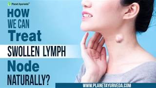 How we can Treat Swollen Lymph node Naturally [upl. by Eduino]