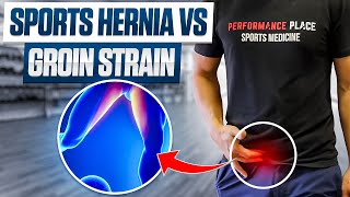 Sports Hernia vs Groin Strain Unraveling the Differences [upl. by Longfellow]