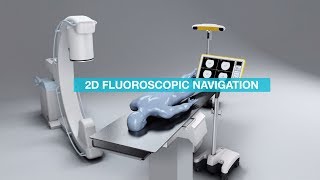 Brainlab Fluoro 2D Registration and Navigation [upl. by Liebman]