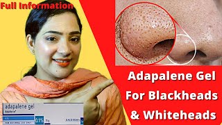 Adapalene Gel Adaferin 01 Review In Hindi  Gel For Blackheads and Whiteheads [upl. by Legna]