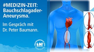 Medizinzeit BauchschlagaderAneurysma  Im Gespräch mit Dr Peter Baumann [upl. by Varuag]