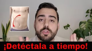 7 señales de que tu dolor de abdomen es apendicitis [upl. by Norrag]