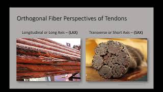 Musculoskeletal Ultrasound Assessment of Tendinopathy [upl. by Adnawt997]