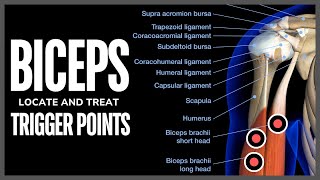 Understanding Trigger Points in the Biceps Muscle [upl. by Garneau]