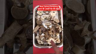 Human Real Spines  Vertebrae  रीड़ की हड्डियाँ short trending viralshorts [upl. by Nortal]