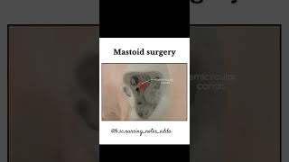 Mastoid surgery procedureanatomy reels hearttouching study youtube ytshorts ytviral [upl. by Erastus69]