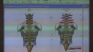 Chiropractic Adjustment Surface EMG Scans amp Spinal Alignment by Dr Madden [upl. by Pleione]