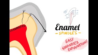 Enamel Spindles Structure of enamel Oral histology [upl. by Marinelli]