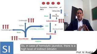 Laboratory diagnosis of jaundice [upl. by Henni651]