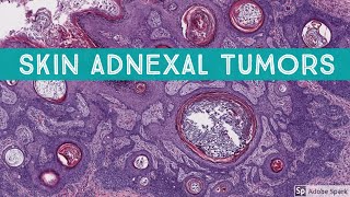 Skin Adnexal Tumors Dermatopathology Unknown Cases [upl. by Eynaffit]