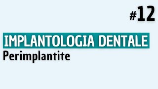 Implantologia Dentale  Perimplantite [upl. by Sophronia]