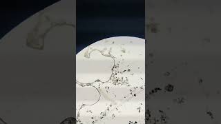 Zooplankton found in pond water biology microscopevideo [upl. by Inavoig]