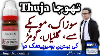 Thuja Homeopathic Medicine  thuja 200 homeopathic medicine uses in hindi  thuja 30 uses  Thuja Q [upl. by Hazlett]