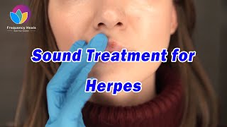 Herpes Healing丨Reduce the pain of herpes丨Healing Frequency丨Care for your skin [upl. by Eceinert]