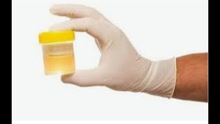 RACCOLTA delle URINE per SCOPO DIAGNOSTICO ELIMINAZIONE CORSO OSS Futuri OSS [upl. by Anika]