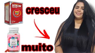 CÁPSULA OU Goma QUAL FAZ CRESCER CABELO MAIS RAPIDO [upl. by Ahl519]