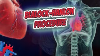 Blalock–Hanlon procedure Human Heart ❤️ amp Cardiology ❤️🔊✅ Human Heart ❤️ amp Cardiology ❤️🔊✅ [upl. by Anoerb]