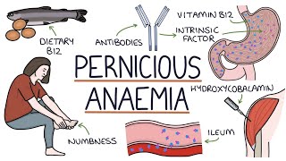 Pernicious Anemia Causes Symptoms Treatment amp Diagnosis Explained [upl. by Woermer]