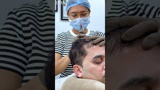 Cara Clinic Hair PRP Treatment Everything You Need to Know [upl. by Ymarej961]