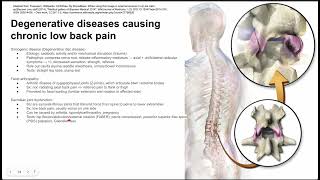 Degenerative diseases causing chronic low back pain [upl. by Canter]