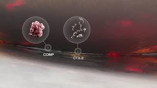 Pentosan polysulfate sodium PPS potential mechanism of action in osteoarthritis [upl. by Sankey]