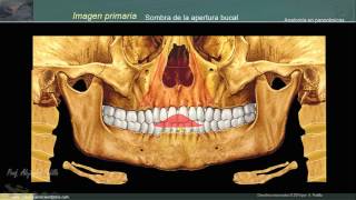 Estructuras anatómicas en la radiografía panorámica II [upl. by Tripp]