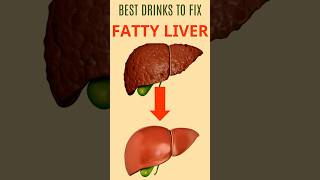 Top Drinks for Fatty Liver Protection [upl. by Lindgren433]