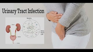 Urinary Tract Infection in children [upl. by Notyard]