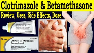 clotrimazole and betamethasone dipropionate cream usp  Review Actavis Cream Usp  Uses Side Effcet [upl. by Trovillion771]