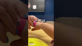 Metacarpal Fractures Kinesio Taping [upl. by Ressay343]